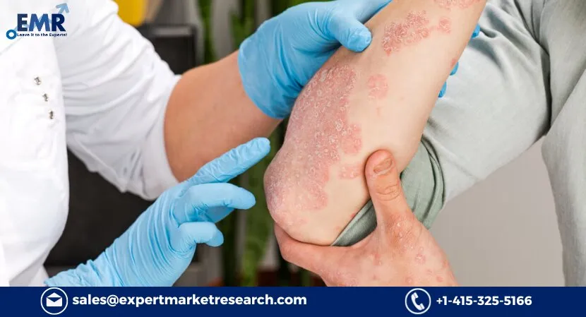 Plaque Psoriasis Treatment Market