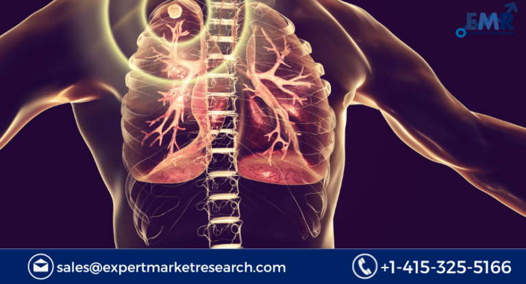 Tuberculosis Treatment Market Size, Growth, Share 2023-2031