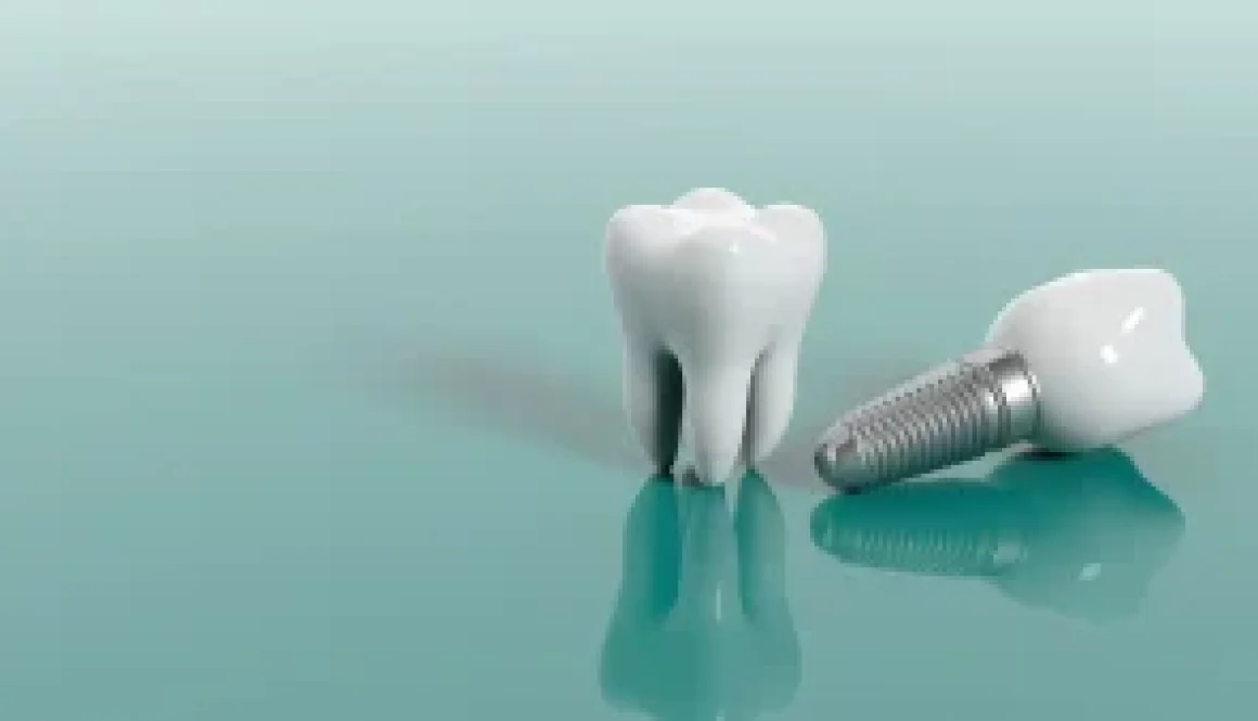 teeth implants hawick
