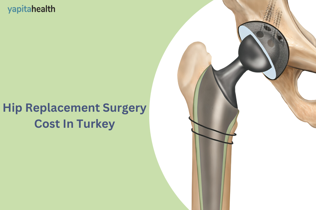 Affordable bilateral total hip replacement surgery in Turkey