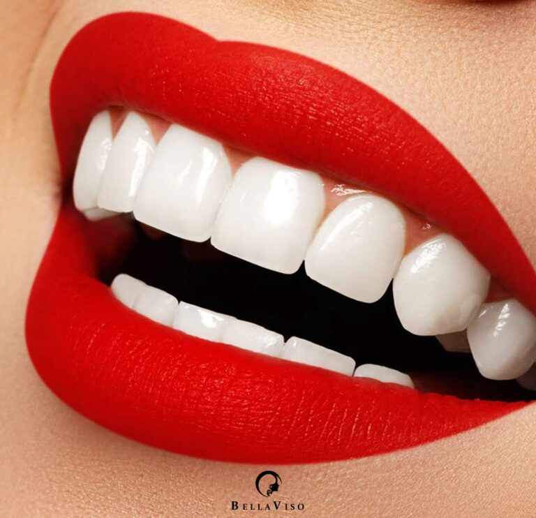 Transform Your Smile: The Best Dental Veneers Treatment in Dubai