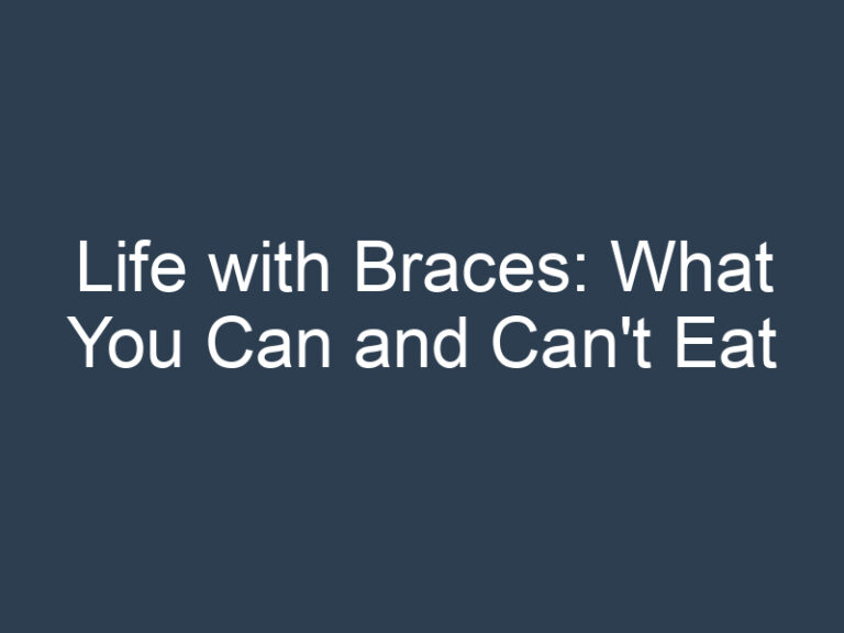 Life with Braces: What You Can and Can’t Eat
